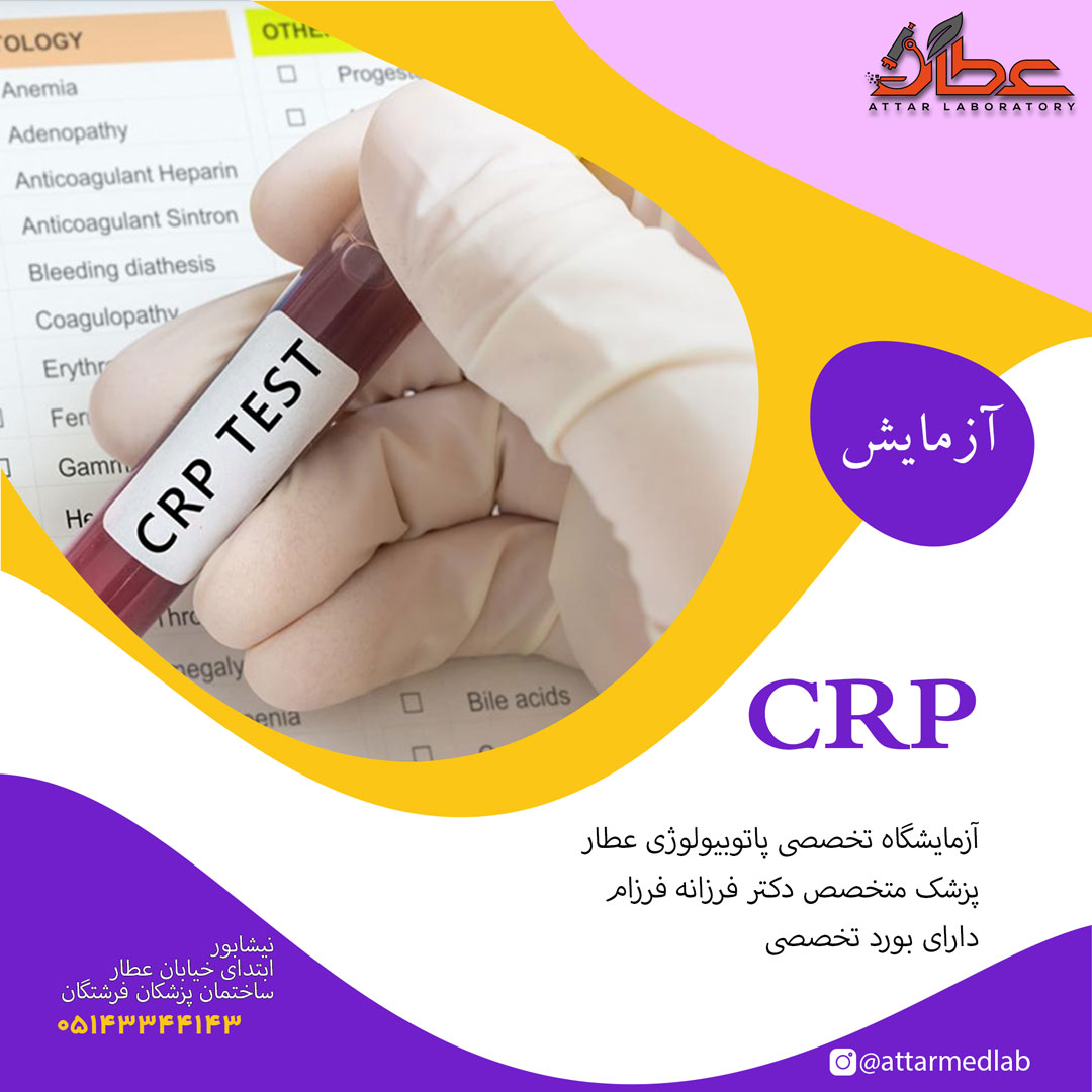 آزمایش CRP