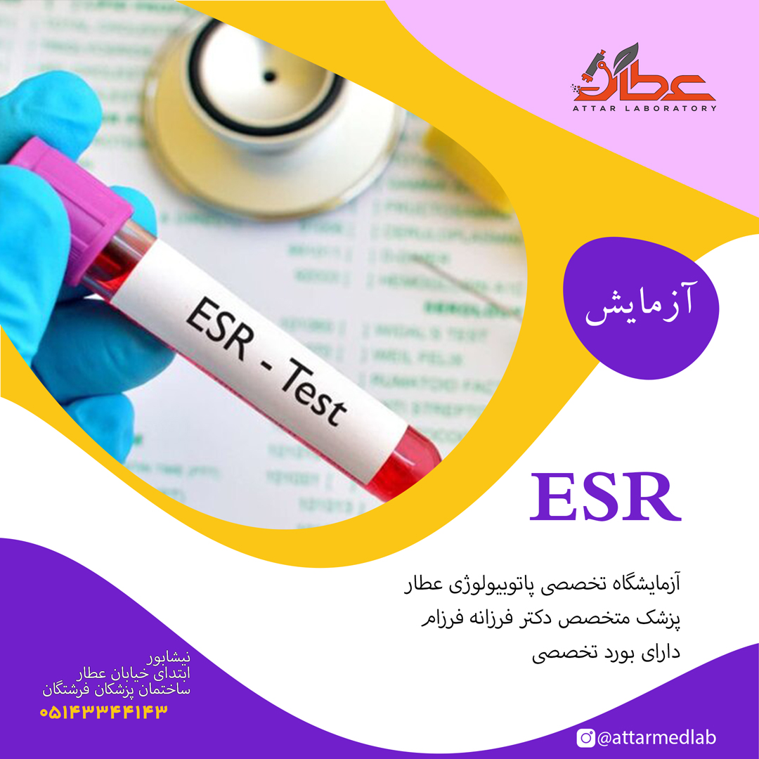 آزمایش ESR